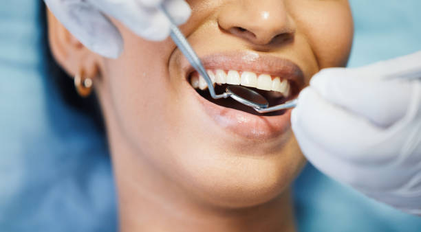 Best Emergency Dental Services for Seniors in New Cordell, OK