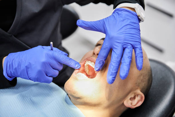 Best Emergency Dentist for Lost Fillings or Crowns in New Cordell, OK